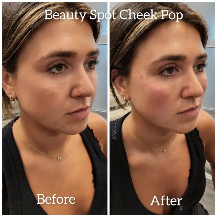 Before and after: Beauty Spot Cheek Pop, right side