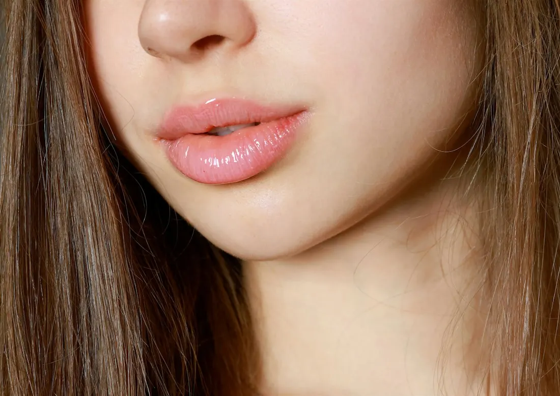 Lip filler